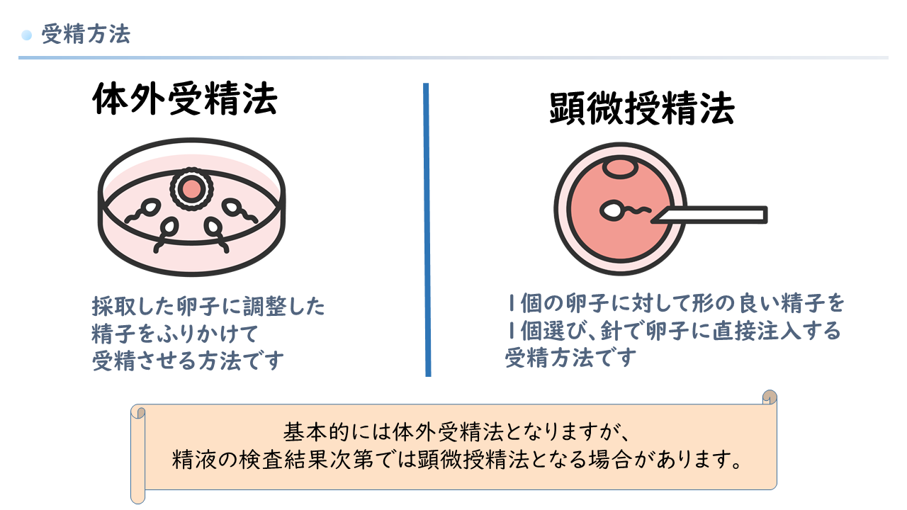 体外受精法・顕微授精法