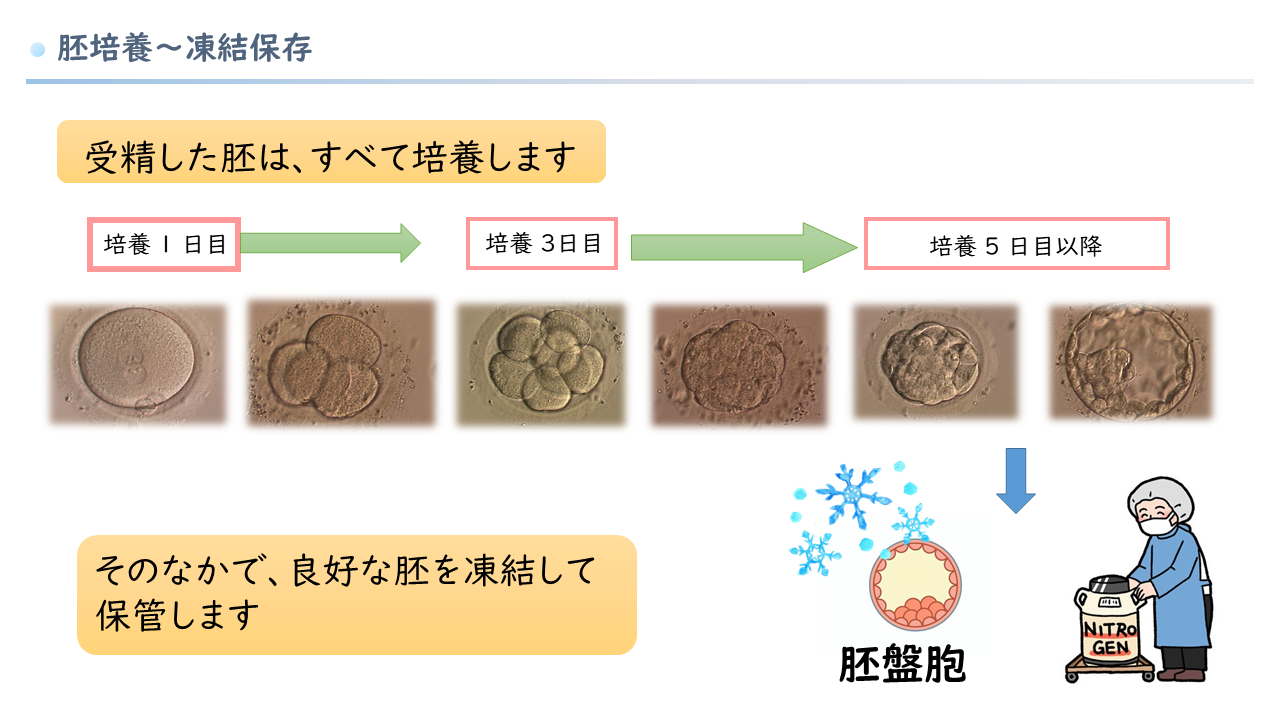 培養
