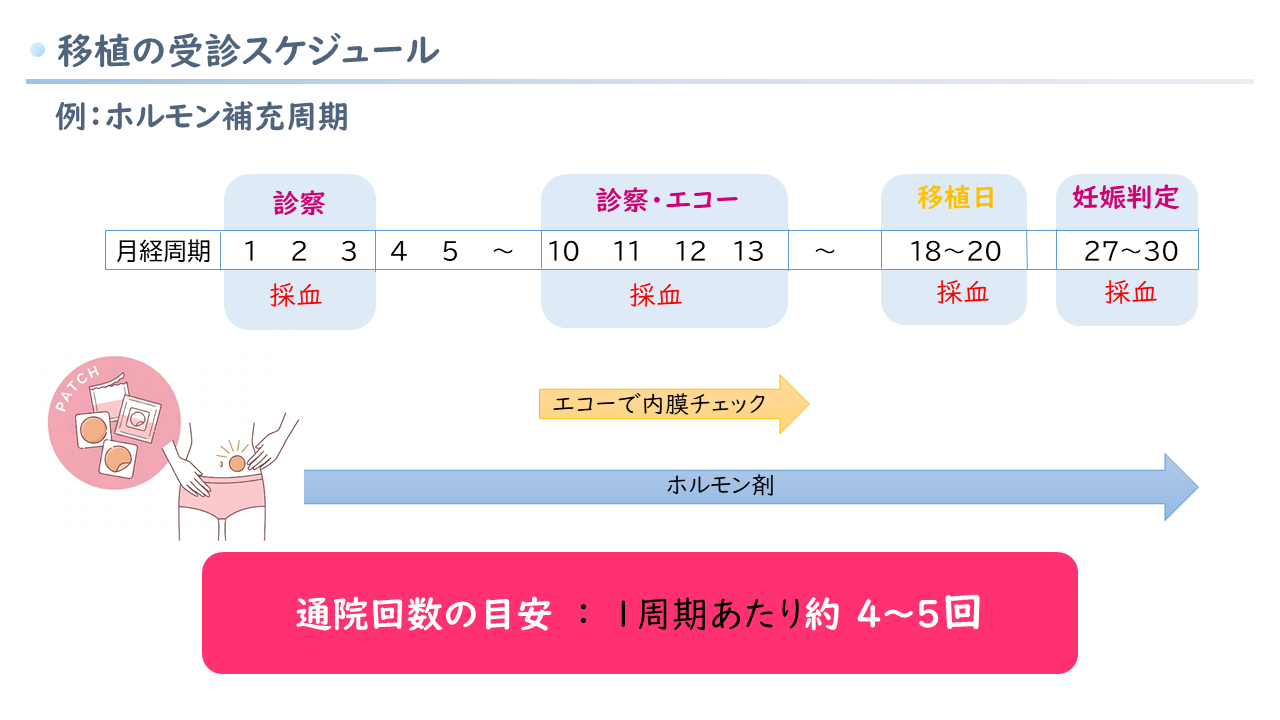 移植スケジュール
