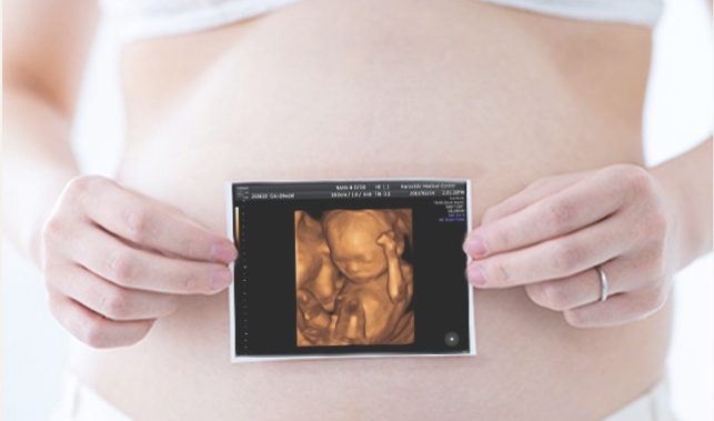 エコー動画オンライン閲覧サービス